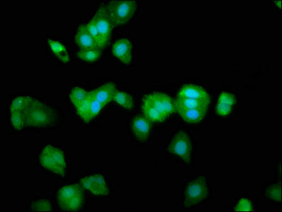 Immunofluorescence staining of HepG2 cells with TRPV2 Antibody at 1:266, counter-stained with DAPI. The cells were fixed in 4% formaldehyde, permeabilized using 0.2% Triton X-100 and blocked in 10% normal Goat Serum. The cells were then incubated with the antibody overnight at 4°C. The secondary antibody was Alexa Fluor 488-congugated AffiniPure Goat Anti-Rabbit IgG(H+L).Rabbit anti-Human TRPV2 Polyclonal Antibody