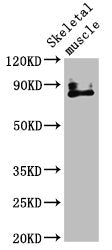 Western Blot | Positive WB detected in: Mouse skeletal muscle tissue | All lanes: TRPV2 antibody at 4.51μg/ml | Secondary | Goat polyclonal to rabbit IgG at 1/50000 dilution | Predicted band size: 86 kDa | Observed band size: 86 kDaRabbit anti-Human TRPV2 Polyclonal Antibody