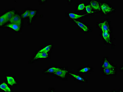 Immunofluorescent analysis of Hela cells using LIPG Antibody at dilution of 1:100 and Alexa Fluor 488-congugated AffiniPure Goat Anti-Rabbit IgG(H+L)