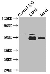 Immunoprecipitating LIPG in HepG2 whole cell lysate | Lane 1: Rabbit control IgG instead of LIPG Antibody in HepG2 whole cell lysate. | For western blotting, a HRP-conjugated Protein G antibody was used as the secondary antibody (1/2000) | Lane 2: LIPG Antibody (8μg) + HepG2 whole cell lysate (500μg) | Lane 3: HepG2 whole cell lysate (10μg)