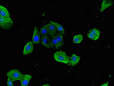 Immunofluorescence staining of HepG2 cells with LYVE1 Antibody at 1:200, counter-stained with DAPI. The cells were fixed in 4% formaldehyde, permeabilized using 0.2% Triton X-100 and blocked in 10% normal Goat Serum. The cells were then incubated with the antibody overnight at 4°C. The secondary antibody was Alexa Fluor 488-congugated AffiniPure Goat Anti-Rabbit IgG(H+L).
