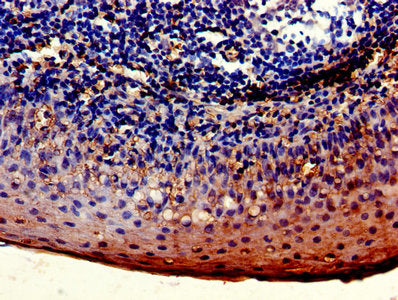 Immunohistochemistry of paraffin-embedded human tonsil tissue using LYVE1 Antibody at dilution of 1:100