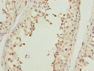 Immunohistochemistry of paraffin-embedded human testis tissue using ACTL7B Antibody at dilution of 1:100
