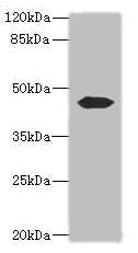 Western blot | All lanes: ACTL7B antibody at 0.2μg/ml + Mouse gonadal tissue | Secondary | Goat polyclonal to rabbit IgG at 1/10000 dilution | Predicted band size: 45 kDa | Observed band size: 45 kDa