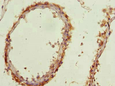 Immunohistochemistry of paraffin-embedded human testis tissue using AP4B1 Antibody at dilution of 1:100Rabbit anti-Human AP4B1 Polyclonal Antibody