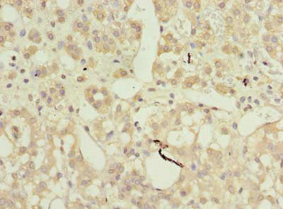 Immunohistochemistry of paraffin-embedded human adrenal gland tissue using AP4B1 Antibody at dilution of 1:100Rabbit anti-Human AP4B1 Polyclonal Antibody