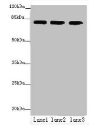 Western blot | All lanes: AP4B1 antibody at 3μg/ml | Lane 1: HepG2 whole cell lysate | Lane 2: U251 whole cell lysate | Lane 3: LO2 whole cell lysate | Secondary | Goat polyclonal to rabbit IgG at 1/10000 dilution | Predicted band size: 84, 35 kDa | Observed band size: 84 kDaRabbit anti-Human AP4B1 Polyclonal Antibody