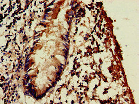 Immunohistochemistry of paraffin-embedded human appendix tissue using WSB1 Antibody at dilution of 1:100Rabbit anti-Human WSB1 Polyclonal Antibody