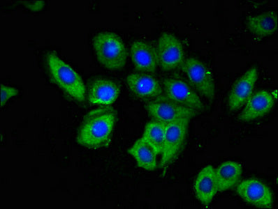 Immunofluorescent analysis of A549 cells using OAS3 Antibody at dilution of 1:100 and Alexa Fluor 488-congugated AffiniPure Goat Anti-Rabbit IgG(H+L)Rabbit anti-Human OAS3 Polyclonal Antibody