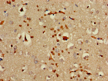 Immunohistochemistry of paraffin-embedded human brain tissue using OAS3 Antibody at dilution of 1:100Rabbit anti-Human OAS3 Polyclonal Antibody