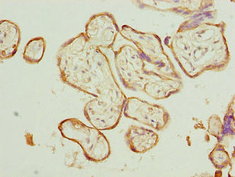 Immunohistochemistry of paraffin-embedded human placenta tissue using CAPN6 Antibody at dilution of 1:100