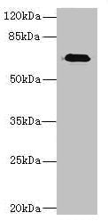 Western blot | All lanes: CAPN6 antibody at 5μg/ml + Human placenta tissue | Secondary | Goat polyclonal to rabbit IgG at 1/10000 dilution | Predicted band size: 75 kDa | Observed band size: 75 kDa