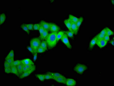 Immunofluorescence staining of HepG2 cells with NUMBL Antibody at 1:100, counter-stained with DAPI. The cells were fixed in 4% formaldehyde, permeabilized using 0.2% Triton X-100 and blocked in 10% normal Goat Serum. The cells were then incubated with the antibody overnight at 4°C. The secondary antibody was Alexa Fluor 488-congugated AffiniPure Goat Anti-Rabbit IgG(H+L).Rabbit anti-Human NUMBL Polyclonal Antibody