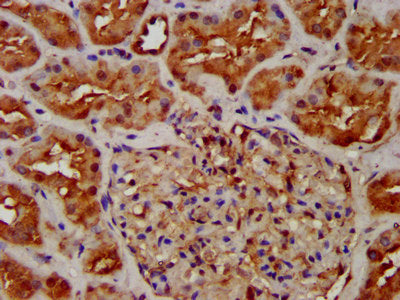 IHC image of NUMBL Antibody diluted at 1:300 and staining in paraffin-embedded human kidney tissue performed on a Leica BondTM system. After dewaxing and hydration, antigen retrieval was mediated by high pressure in a citrate buffer (pH 6.0). Section was blocked with 10% normal goat serum 30min at RT. Then primary antibody (1% BSA) was incubated at 4°C overnight. The primary is detected by a biotinylated secondary antibody and visualized using an HRP conjugated SP system.Rabbit anti-Human NUMBL Polyclonal Antibody