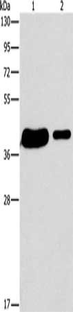 Gel: 15%SDS-PAGE, Lysate: 40 μg, Lane 1-2: 293T cells, A431 cells, Primary antibody: SAE1 Antibody(SAE1 Antibody) at dilution 1/400, Secondary antibody: Goat anti rabbit IgG at 1/8000 dilution, Exposure time: 30 secondsRabbit anti-Human SAE1 Polyclonal Antibody