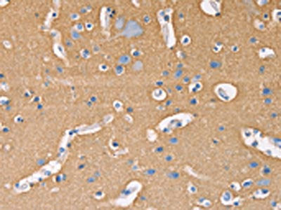 The image on the left is immunohistochemistry of paraffin-embedded Human brain tissue using the antibody Antibody) at dilution 1/20, on the right is treated with fusion protein. (Original magnification: ×200)Rabbit anti-Human GNB1 Polyclonal Antibody