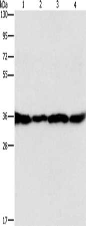 Gel: 15%SDS-PAGE, Lysate: 40 μg, Lane 1-4: HepG2 cells, A549 cells, 293T cells, 231 cells, Primary antibody: GNB1 Antibody(GNB1 Antibody) at dilution 1/400, Secondary antibody: Goat anti rabbit IgG at 1/8000 dilution, Exposure time: 1 secondRabbit anti-Human GNB1 Polyclonal Antibody