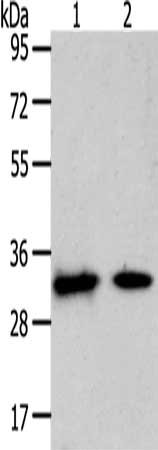 Gel: 10%SDS-PAGE, Lysate: 40 μg, Lane 1-2: Mouse heart tissue, Mouse muscle tissue, Primary antibody: SLC25A4 Antibody(SLC25A4 Antibody) at dilution 1/400, Secondary antibody: Goat anti rabbit IgG at 1/8000 dilution, Exposure time: 1 minuteRabbit anti-Human SLC25A4 Polyclonal Antibody