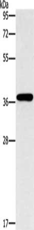 Gel: 10%SDS-PAGE, Lysate: 40 μg, Lane: HepG2 cells, Primary antibody: MARC1 Antibody(MARC1 Antibody) at dilution 1/1400, Secondary antibody: Goat anti rabbit IgG at 1/8000 dilution, Exposure time: 40 seconds