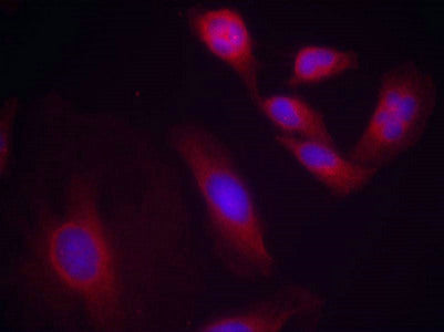 Immunofluorescence staining of methanol-fixed Hela cells using NFkB-p65(Phospho-Ser536) Antibody.Rabbit anti-Human RELA Polyclonal Antibody