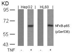 Western blot analysis of extracts from HepG2 and HL60 cells untreated or treated with TNF using NFkB-p65(Phospho-Ser536) Antibody.Rabbit anti-Human RELA Polyclonal Antibody