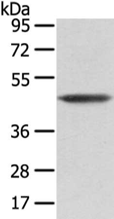 Gel: 8%SDS-PAGE, Lysate: 40 μg, Lane: NIH/3T3 cell, Primary antibody: VASH1 Antibody(VASH1 Antibody) at dilution 1/200 dilution, Secondary antibody: Goat anti rabbit IgG at 1/8000 dilution, Exposure time: 10 secondsRabbit anti-Human VASH1 Polyclonal Antibody