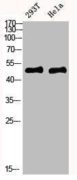 Western blot analysis of mouse-kidney mouse-brain mouse-lung mouse-heart 293T lysate, antibody was diluted at 1000. Secondary antibody  was diluted at 1:20000