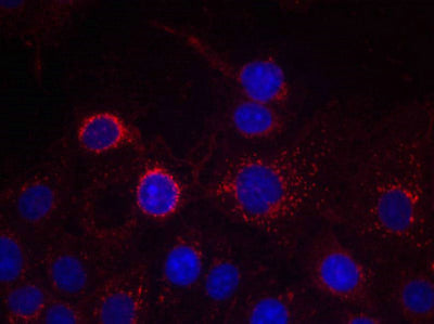 Immunofluorescence staining of methanol-fixed MCF cells using HER2(Ab-1221/1222) Antibody.Rabbit anti-Human ERBB2 Polyclonal Antibody