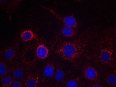 Immunofluorescence staining of methanol-fixed MCF cells using HER2(Ab-1221/1222) Antibody.Rabbit anti-Human ERBB2 Polyclonal Antibody
