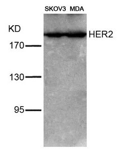 Western blot analysis of extracts from SKOV3 and MDA cells using HER2(Ab-1221/1222) Antibody.Rabbit anti-Human ERBB2 Polyclonal Antibody