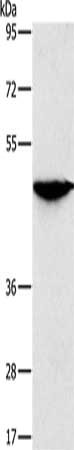 Gel: 8%SDS-PAGE, Lysate: 40 μg, Lane: Human fetal brain tissue, Primary antibody: SOX11 Antibody(SOX11 Antibody) at dilution 1/250, Secondary antibody: Goat anti rabbit IgG at 1/8000 dilution, Exposure time: 5 minutesRabbit anti-Human SOX11 Polyclonal Antibody