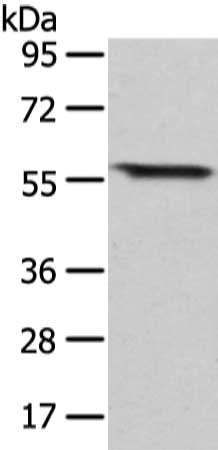Gel: 8%SDS-PAGE, Lysate: 40 μg, Lane: Human fetal intestines tissue, Primary antibody: GRB14 Antibody(GRB14 Antibody) at dilution 1/350 dilution, Secondary antibody: Goat anti rabbit IgG at 1/8000 dilution, Exposure time: 20 secondsRabbit anti-Human GRB14 Polyclonal Antibody
