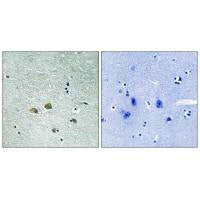 Immunohistochemistry analysis of paraffin-embedded human brain tissue using PAK1 (Ab-204) antibody.Rabbit anti-Human PAK1 Polyclonal Antibody