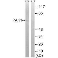Western blot analysis of extracts from 3T3 cells, treated with UV (15mins), using PAK1 (Ab-204) antibody.Rabbit anti-Human PAK1 Polyclonal Antibody