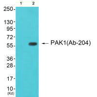 Western blot analysis of extracts from cos-7 cells (Lane 2), using PAK1 (Ab-204) antiobdy. The lane on the left is treated with synthesized peptide.Rabbit anti-Human PAK1 Polyclonal Antibody