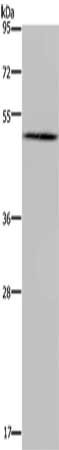 Gel: 8%SDS-PAGE, Lysate: 40 μg, Lane: Human hepatocellular carcinoma tissue, Primary antibody: BMP3 Antibody(BMP3 Antibody) at dilution 1/200, Secondary antibody: Goat anti rabbit IgG at 1/8000 dilution, Exposure time: 20 seconds