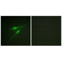 Immunofluorescence analysis of NIH/3T3 cells, using p38 MAPK (Ab-322) antibody.