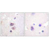 Immunohistochemistry analysis of paraffin-embedded human brain tissue using p38 MAPK (Ab-322) antibody.
