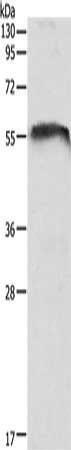 Gel: 10%SDS-PAGE, Lysate: 40 μg, Lane: Mouse brain tissue, Primary antibody: CDH23 Antibody(CDH23 Antibody) at dilution 1/1050, Secondary antibody: Goat anti rabbit IgG at 1/8000 dilution, Exposure time: 20 secondsRabbit anti-Human CDH23 Polyclonal Antibody