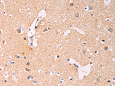 The image on the left is immunohistochemistry of paraffin-embedded Human brain tissue using the antibody Antibody) at dilution 1/60, on the right is treated with synthetic peptide. (Original magnification: ×200)