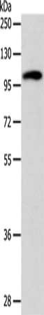 Gel: 8%SDS-PAGE, Lysate: 40 μg, Lane: 293T cells, Primary antibody: ADCY1 Antibody(ADCY1 Antibody) at dilution 1/1000, Secondary antibody: Goat anti rabbit IgG at 1/8000 dilution, Exposure time: 10 minutesRabbit anti-Human ADCY1 Polyclonal Antibody