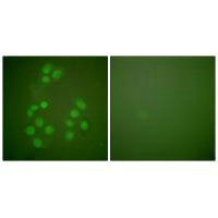 Immunofluorescence analysis of A549 cells, using CREB-BP antibody.Rabbit anti-Human CREBBP Polyclonal Antibody