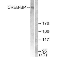 Western blot analysis of extracts from HeLa cells, treated with insulin (0.01U/ml, 15mins), using CREB-BP antibody.Rabbit anti-Human CREBBP Polyclonal Antibody