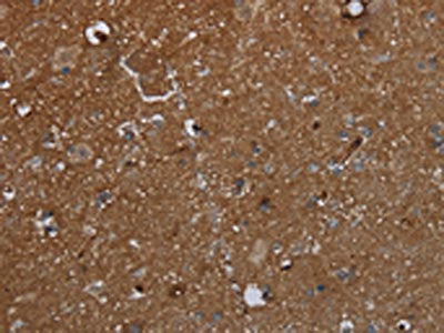 The image on the left is immunohistochemistry of paraffin-embedded Human brain  tissue using GALT Antibody(GALT Antibody) at dilution 1/30, on the right is treated with fusion protein. (Original magnification: ×200)Rabbit anti-Human GALT Polyclonal Antibody