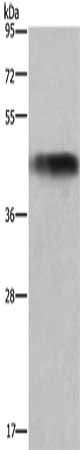 Gel: 8%SDS-PAGE, Lysate: 40 μg, Lane: Human fetal liver tissue, Primary antibody: GALT Antibody(GALT Antibody) at dilution 1/300, Secondary antibody: Goat anti rabbit IgG at 1/8000 dilution, Exposure time: 10 secondsRabbit anti-Human GALT Polyclonal Antibody