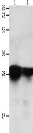 Gel: 12%SDS-PAGE, Lysate: 40 μg, Lane 1-2: Human brain malignant glioma tissue, Human laryngocarcinoma tissue, Primary antibody: YWHAE Antibody(YWHAE Antibody) at dilution 1/2200, Secondary antibody: Goat anti rabbit IgG at 1/8000 dilution, Exposure time: 30 secondsRabbit anti-Human YWHAE Polyclonal Antibody