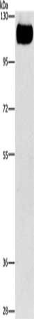 Gel: 6%SDS-PAGE, Lysate: 60 μg, Lane: K562 cells, Primary antibody: TLR4 Antibody(TLR4 Antibody) at dilution 1/550, Secondary antibody: Goat anti rabbit IgG at 1/8000 dilution, Exposure time: 1 minuteRabbit anti-Human TLR4 Polyclonal Antibody