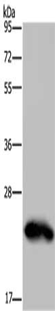 Gel: 10%SDS-PAGE, Lysate: 40 μg, Lane: Human placenta tissue, Primary antibody: GH2 Antibody(GH2 Antibody) at dilution 1/500, Secondary antibody: Goat anti rabbit IgG at 1/8000 dilution, Exposure time: 10 secondsRabbit anti-Human GH2 Polyclonal Antibody