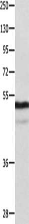 Gel: 10%SDS-PAGE, Lysate: 40 μg, Lane: Mouse thymus tissue, Primary antibody: NAP1L1 Antibody(NAP1L1 Antibody) at dilution 1/1000, Secondary antibody: Goat anti rabbit IgG at 1/8000 dilution, Exposure time: 40 secondsRabbit anti-Human NAP1L1 Polyclonal Antibody