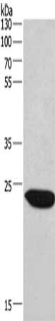 Gel: 12%SDS-PAGE, Lysate: 40 μg, Lane: Mouse lung tissue, Primary antibody: CHMP1A Antibody(CHMP1A Antibody) at dilution 1/530, Secondary antibody: Goat anti rabbit IgG at 1/8000 dilution, Exposure time: 40 seconds